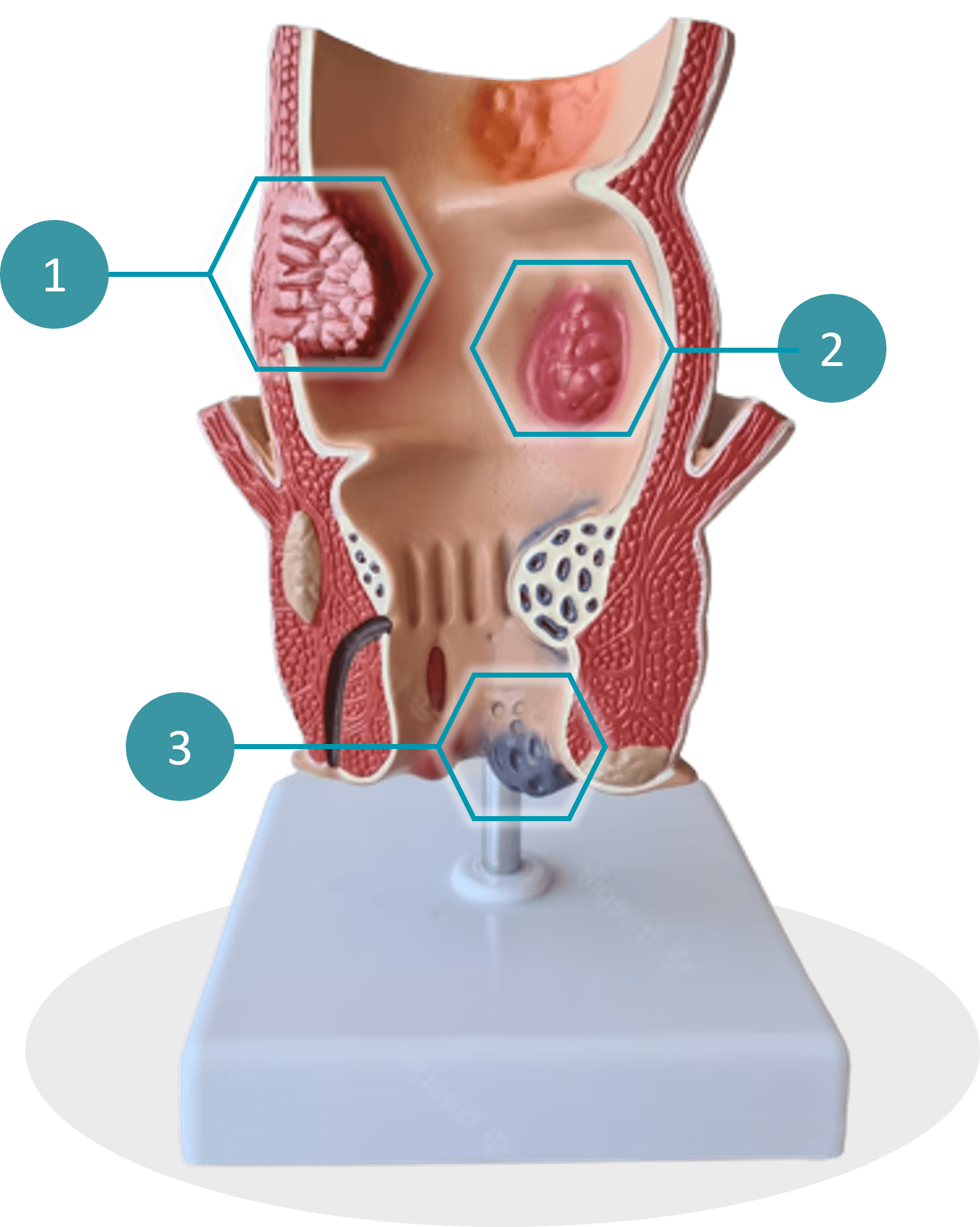 Intestino-3D2.png